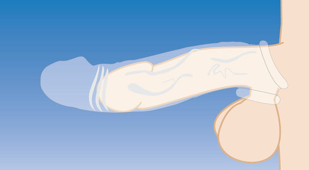 Clear Extender gekrümmte Penis-Hülle