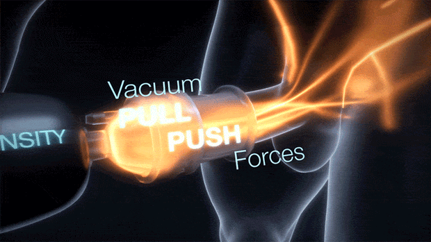 Xtensity 1 – Masturbator – Schwarz